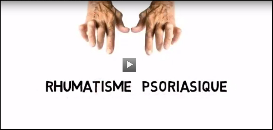 Chapitre 1 : Rhumatisme psoriasique / Mieux connaître et combattre les maladies rhumatismales